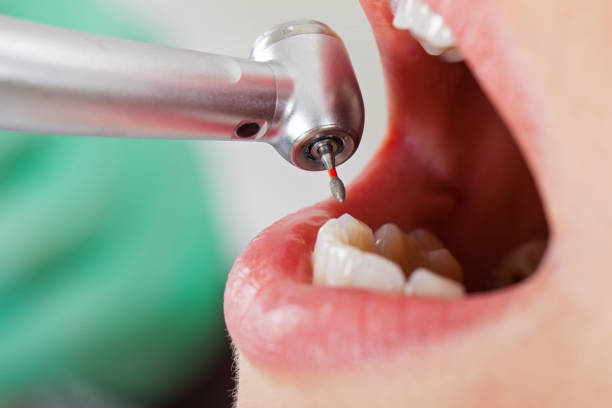 Best Pediatric Emergency Dentist in East Palo Alto, CA